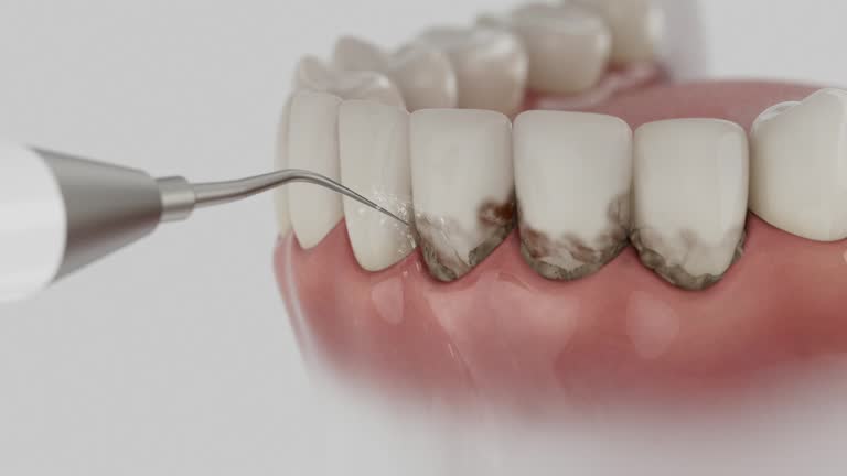 Trusted Teeth Cleaning And Checkup service in Waldorf, MD - Dentist Open Now